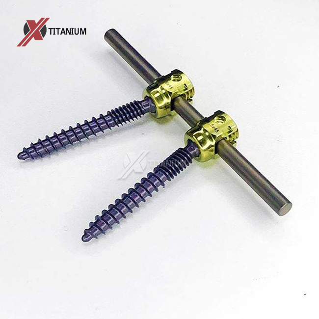 titanium rod implant